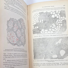Handbook Pathological Anatomy Histology Delafield Prudden 1889 HC Wood Engraving