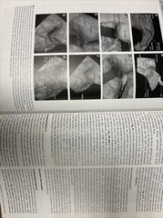 Journal Of Neurological Surgery Part B Skull Base August 2024