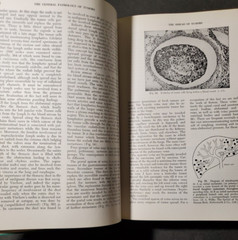 BOYD’S PATHOLOGY FOR THE SURGEON 8th Ed.by William Anderson 1967 HC Saunders