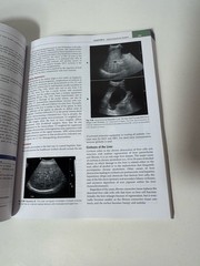 Comprehensive Radiographic Pathology Seventh Edition Eisenberg Johnson PB