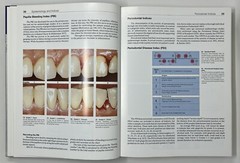 Color Atlas of Dental Medicine: Periodontology by Rateitschak, Wolf & Hassell HC