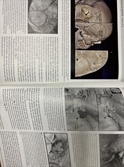 Journal Of Neurological Surgery Part B Skull Base August 2024