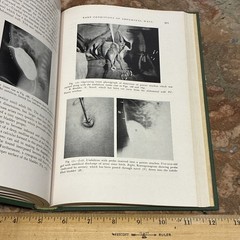 Book Abdominal Surgery of Infancy Childhood William Ladd Surgical Vintage Books