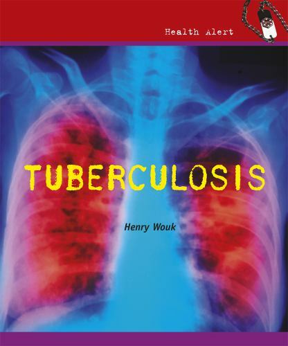 Tuberculosis (Health Alert)