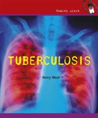 Tuberculosis (Health Alert)