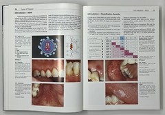Color Atlas of Dental Medicine: Periodontology by Rateitschak, Wolf & Hassell HC
