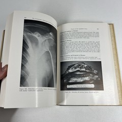 Comparative Pathology of the Tumors of Bone by Jacobson 1971 CSI Vintage Medical