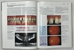 Color Atlas of Dental Medicine: Periodontology by Rateitschak, Wolf & Hassell HC