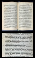 ANTIQUE 19th Century Medical French Book PATHOLOGY diseases DIAGNOSIS Medicine