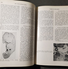 BOYD’S PATHOLOGY FOR THE SURGEON 8th Ed.by William Anderson 1967 HC Saunders