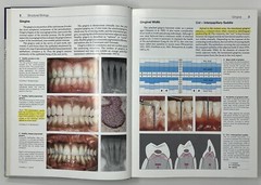 Color Atlas of Dental Medicine: Periodontology by Rateitschak, Wolf & Hassell HC