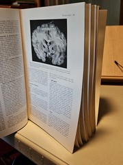 Pathology by W.A.D. Anderson 4th Edition HC Mosby 1961
