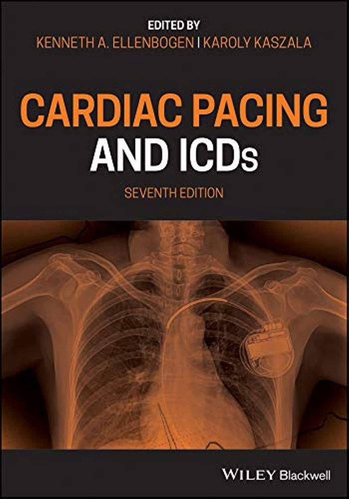 Cardiac Pacing And Icds Paperback p139