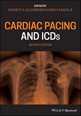 Cardiac Pacing And Icds Paperback p139