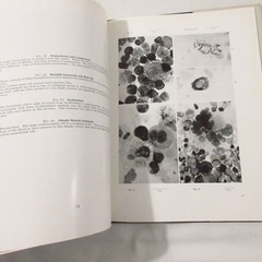 Vintage Medical Book Cancer Pathology Cytology of Effusions Spriggs Color Plates