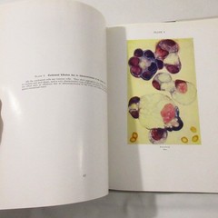 Vintage Medical Book Cancer Pathology Cytology of Effusions Spriggs Color Plates