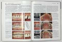 Color Atlas of Dental Medicine: Periodontology by Rateitschak, Wolf & Hassell HC