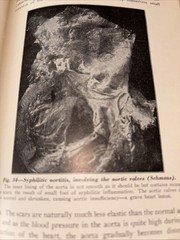 Text Book of pathology 1945, 5th Edition, Illustrated