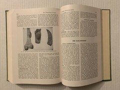 Vtg 1955 Hardcover Pathology for the Surgeon William Boyd 7th Edition Saunders