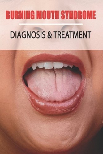 Burning Mouth Syndrome: Diagnosis & Treatment: Burning Mouth Syndrome Guide: New