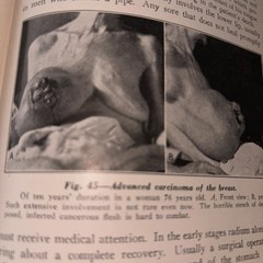 Text Book of pathology 1945, 5th Edition, Illustrated