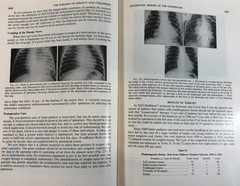 The Surgery of Infancy and Childhood, Gross, 1953, E-119