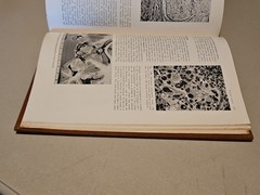 Pathology by W.A.D. Anderson 4th Edition HC Mosby 1961