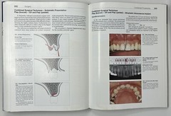 Color Atlas of Dental Medicine: Periodontology by Rateitschak, Wolf & Hassell HC