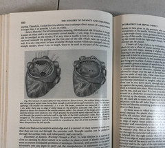 The Surgery of Infancy and Childhood, Gross, 1953, E-119