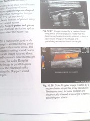 Understanding Ultrasound Physics (Rev Ed) by Edelman, Sidney K.