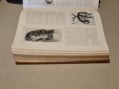 Pathology by W.A.D. Anderson 4th Edition HC Mosby 1961