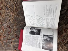 Rockwood Fractures in Adults & Children 2nd Ed Complete 3 Vol Set HC Orthopedic