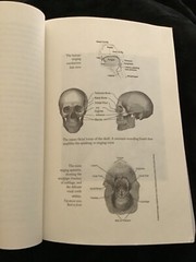 Rearranged:An Opera Singers Facial Cancer And Life Transposed-GOOD-USED-383pages