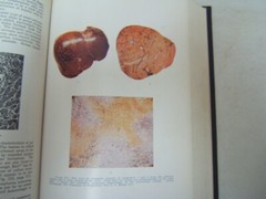 Pathology W A D Anderson 1948 1183 Illustrations 10 Color Plates