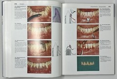 Color Atlas of Dental Medicine: Periodontology by Rateitschak, Wolf & Hassell HC