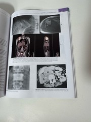 Comprehensive Radiographic Pathology Seventh Edition Eisenberg Johnson PB