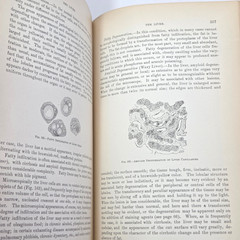 Handbook Pathological Anatomy Histology Delafield Prudden 1889 HC Wood Engraving