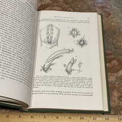 Book Abdominal Surgery of Infancy Childhood William Ladd Surgical Vintage Books